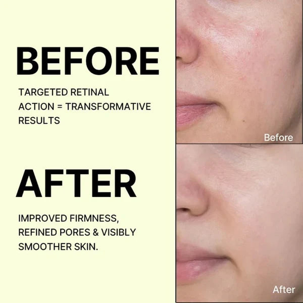 Celimax The Vita-A Retinal Shot Tightening Booster (15ml)